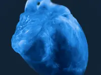 Heart issue